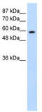 Deleted In Azoospermia 2 antibody, TA345714, Origene, Western Blot image 