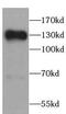 Sirtuin 1 antibody, FNab07877, FineTest, Western Blot image 