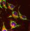 Mannose Receptor C-Type 1 antibody, ab64693, Abcam, Immunofluorescence image 