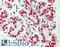 Splicing Factor 3b Subunit 3 antibody, LS-B14465, Lifespan Biosciences, Immunohistochemistry paraffin image 