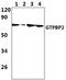 GTP Binding Protein 2 antibody, PA5-75936, Invitrogen Antibodies, Western Blot image 
