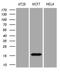 Anterior Gradient 2, Protein Disulphide Isomerase Family Member antibody, LS-C798729, Lifespan Biosciences, Western Blot image 