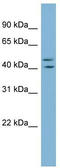 Zinc Finger Protein 517 antibody, TA339851, Origene, Western Blot image 