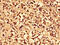 Carbonic Anhydrase 1 antibody, LS-C318090, Lifespan Biosciences, Immunohistochemistry paraffin image 