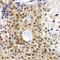 PHD Finger Protein 19 antibody, GTX32787, GeneTex, Immunohistochemistry paraffin image 