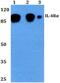 Interleukin-4 receptor subunit alpha antibody, PA5-36394, Invitrogen Antibodies, Western Blot image 