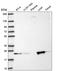 Kelch Repeat And BTB Domain Containing 8 antibody, HPA069190, Atlas Antibodies, Western Blot image 