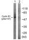 Cyclin B1 antibody, TA312649, Origene, Western Blot image 