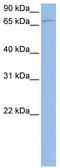 TANK Binding Kinase 1 antibody, TA334468, Origene, Western Blot image 