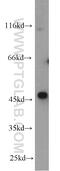 Oxytocin Receptor antibody, 23045-1-AP, Proteintech Group, Western Blot image 