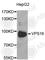 VPS16 Core Subunit Of CORVET And HOPS Complexes antibody, A4932, ABclonal Technology, Western Blot image 