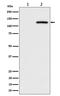 Cbl Proto-Oncogene antibody, P00152-1, Boster Biological Technology, Western Blot image 