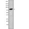 Phosphoinositide-3-Kinase Regulatory Subunit 6 antibody, abx148733, Abbexa, Western Blot image 