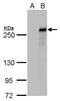 Tet Methylcytosine Dioxygenase 2 antibody, GTX629879, GeneTex, Western Blot image 