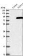WD And Tetratricopeptide Repeats 1 antibody, NBP1-89235, Novus Biologicals, Western Blot image 
