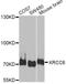 X-Ray Repair Cross Complementing 6 antibody, STJ29469, St John