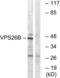 VPS26, Retromer Complex Component B antibody, LS-C120462, Lifespan Biosciences, Western Blot image 