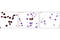 Progesterone Receptor antibody, 8757S, Cell Signaling Technology, Immunohistochemistry paraffin image 