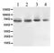ATP Binding Cassette Subfamily B Member 10 antibody, PB9971, Boster Biological Technology, Western Blot image 