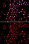 Karyopherin Subunit Alpha 4 antibody, GTX54358, GeneTex, Immunofluorescence image 