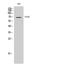 Tigger Transposable Element Derived 1 antibody, A17411, Boster Biological Technology, Western Blot image 