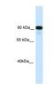 Class II Major Histocompatibility Complex Transactivator antibody, NBP1-91543, Novus Biologicals, Western Blot image 