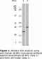 Eukaryotic Translation Initiation Factor 4E Binding Protein 1 antibody, LS-C47198, Lifespan Biosciences, Western Blot image 