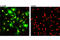 Liver-type arginase antibody, 93668S, Cell Signaling Technology, Immunocytochemistry image 