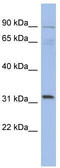 TBC1 Domain Family Member 14 antibody, TA335907, Origene, Western Blot image 