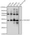 Carcinoembryonic Antigen Related Cell Adhesion Molecule 3 antibody, A2589, ABclonal Technology, Western Blot image 