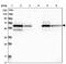 Coenzyme A Synthase antibody, PA5-54626, Invitrogen Antibodies, Western Blot image 