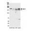 Bromodomain Adjacent To Zinc Finger Domain 1B antibody, NB600-279, Novus Biologicals, Western Blot image 