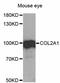 Collagen Type II Alpha 1 Chain antibody, A1560, ABclonal Technology, Western Blot image 