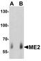 Malic Enzyme 2 antibody, A01380, Boster Biological Technology, Western Blot image 
