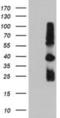 TIMP Metallopeptidase Inhibitor 2 antibody, NBP2-01573, Novus Biologicals, Western Blot image 