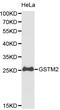 Glutathione S-Transferase Mu 2 antibody, LS-C192468, Lifespan Biosciences, Western Blot image 