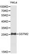 Glutathione S-transferase Mu 2 antibody, LS-C192468, Lifespan Biosciences, Western Blot image 