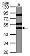 Ribosomal Protein S6 Kinase B2 antibody, PA5-27561, Invitrogen Antibodies, Western Blot image 
