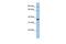 SLAM family member 6 antibody, GTX45893, GeneTex, Western Blot image 