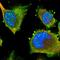 Capping Protein Regulator And Myosin 1 Linker 1 antibody, HPA029039, Atlas Antibodies, Immunofluorescence image 