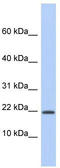 Host Cell Factor C1 Regulator 1 antibody, TA336194, Origene, Western Blot image 