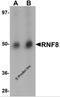 E3 ubiquitin-protein ligase RNF8 antibody, 5763, ProSci Inc, Western Blot image 