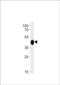 Carbohydrate Sulfotransferase 11 antibody, PA5-72647, Invitrogen Antibodies, Western Blot image 