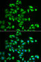 Protein O-Linked Mannose N-Acetylglucosaminyltransferase 2 (Beta 1,4-) antibody, STJ28567, St John