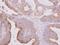 Tubulin Beta 2A Class IIa antibody, NBP2-15580, Novus Biologicals, Immunohistochemistry paraffin image 