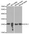 Ubiquitin C-Terminal Hydrolase L1 antibody, MBS126483, MyBioSource, Western Blot image 