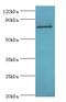 Heterogeneous Nuclear Ribonucleoprotein M antibody, LS-C375908, Lifespan Biosciences, Western Blot image 