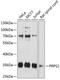 Phosphoribosyl Pyrophosphate Synthetase 2 antibody, GTX64723, GeneTex, Western Blot image 