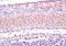 Calcium Voltage-Gated Channel Subunit Alpha1 S antibody, orb1137, Biorbyt, Immunohistochemistry paraffin image 