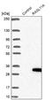 RAS Like Family 11 Member A antibody, NBP2-30368, Novus Biologicals, Western Blot image 